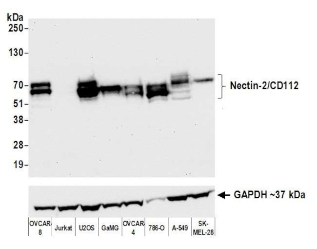 CD112 (Nectin-2) Antibody in Western Blot (WB)