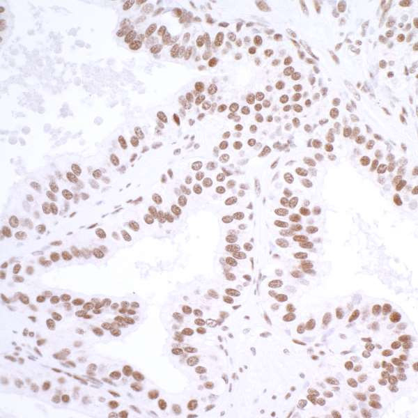 USP7 Antibody in Immunohistochemistry (Paraffin) (IHC (P))