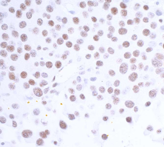 USP7 Antibody in Immunohistochemistry (Paraffin) (IHC (P))