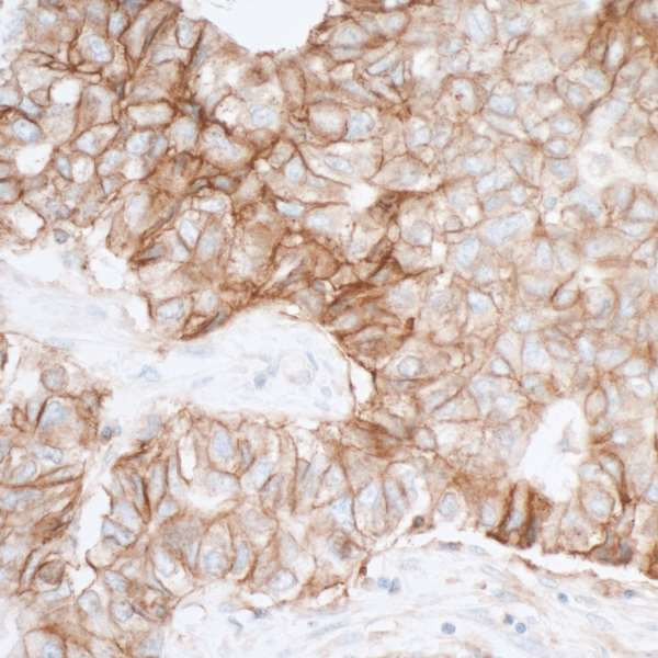 CD155 Antibody in Immunohistochemistry (Paraffin) (IHC (P))