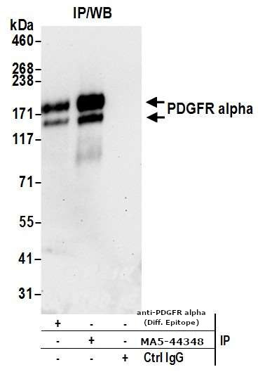 CD140a (PDGFRA) Antibody in Immunoprecipitation (IP)