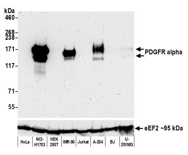 CD140a (PDGFRA) Antibody in Western Blot (WB)