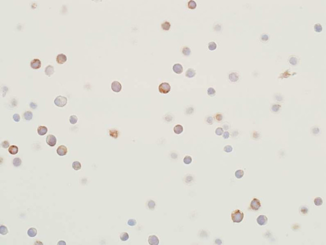 MEK2 Antibody in Immunocytochemistry (ICC/IF)