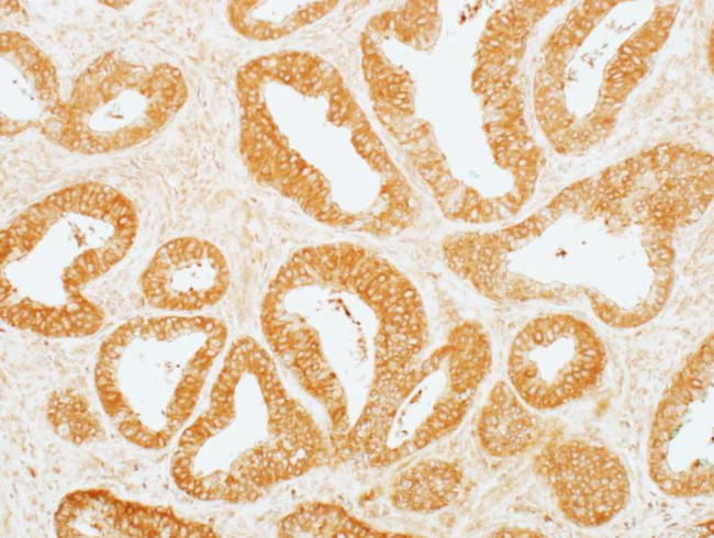 MEK2 Antibody in Immunohistochemistry (Paraffin) (IHC (P))