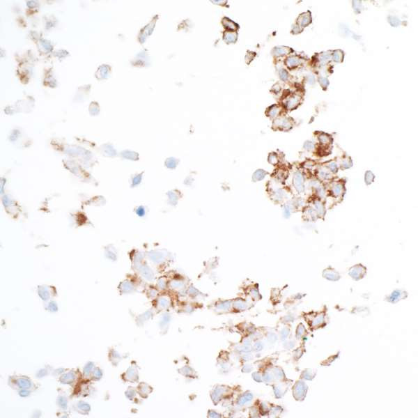 CD140b (PDGFRB) Antibody in Immunocytochemistry (ICC/IF)