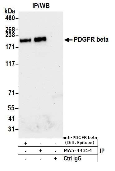 CD140b (PDGFRB) Antibody in Immunoprecipitation (IP)