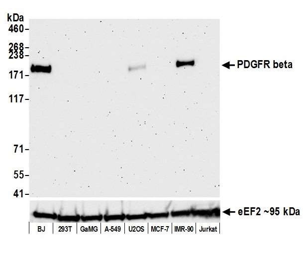 CD140b (PDGFRB) Antibody in Western Blot (WB)