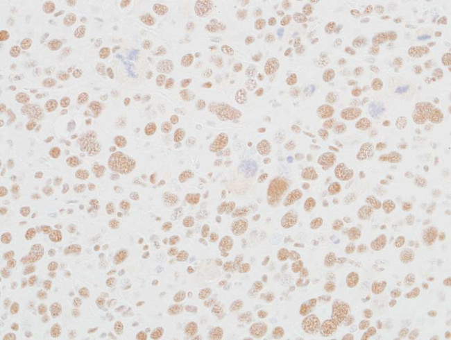 MED12 Antibody in Immunohistochemistry (Paraffin) (IHC (P))