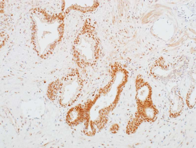 CDK1 Antibody in Immunohistochemistry (Paraffin) (IHC (P))