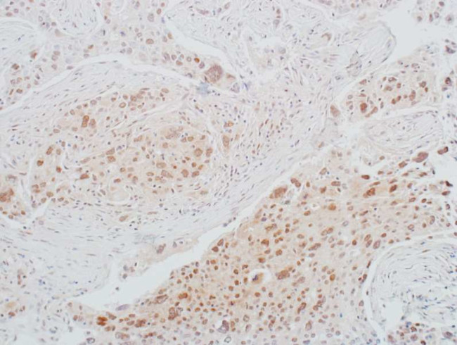 CDK1 Antibody in Immunohistochemistry (Paraffin) (IHC (P))