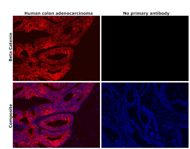 beta Catenin Antibody in Immunohistochemistry (Paraffin) (IHC (P))