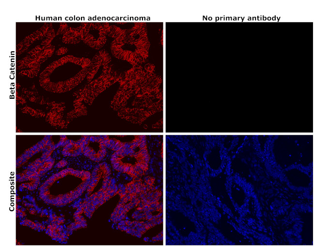 beta Catenin Antibody in Immunohistochemistry (Paraffin) (IHC (P))