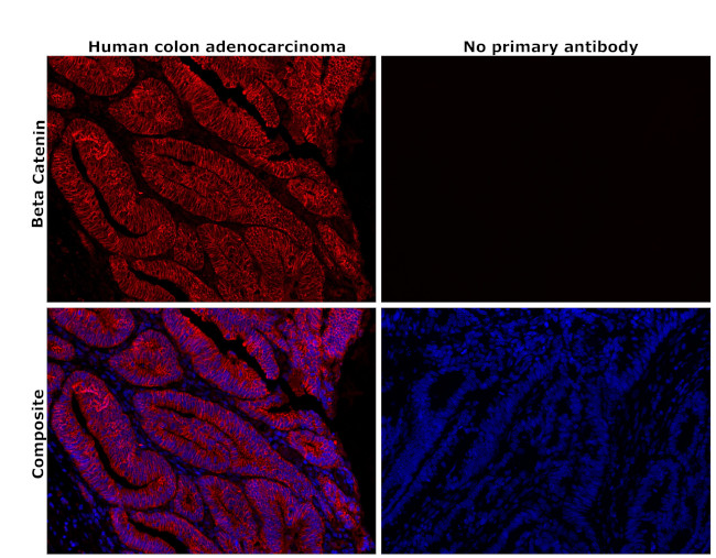 beta Catenin Antibody in Immunohistochemistry (Paraffin) (IHC (P))