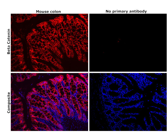 beta Catenin Antibody in Immunohistochemistry (Paraffin) (IHC (P))