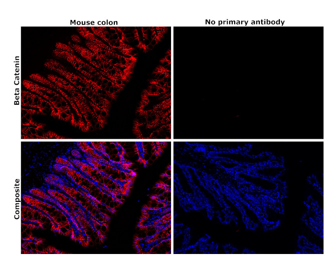 beta Catenin Antibody in Immunohistochemistry (Paraffin) (IHC (P))