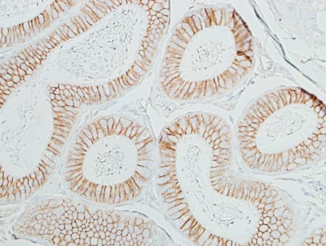 beta Catenin Antibody in Immunohistochemistry (Paraffin) (IHC (P))