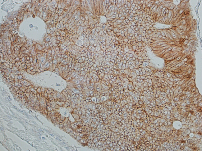 beta Catenin Antibody in Immunohistochemistry (Paraffin) (IHC (P))