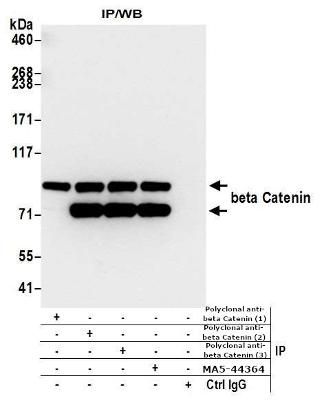 beta Catenin Antibody in Immunoprecipitation (IP)