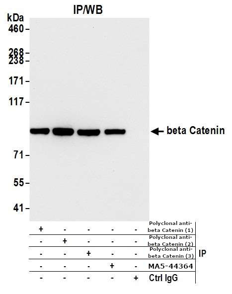 beta Catenin Antibody in Immunoprecipitation (IP)