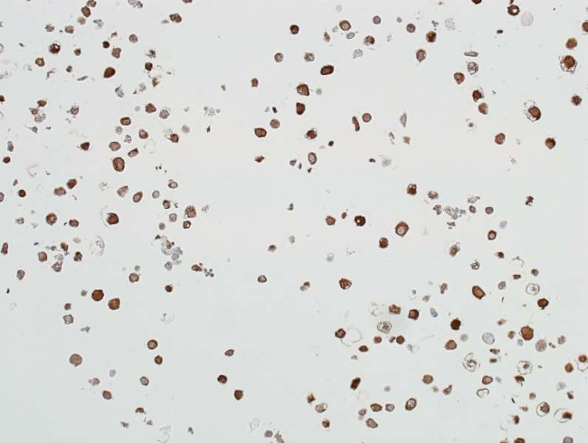 ALDH1A1 Antibody in Immunocytochemistry (ICC/IF)