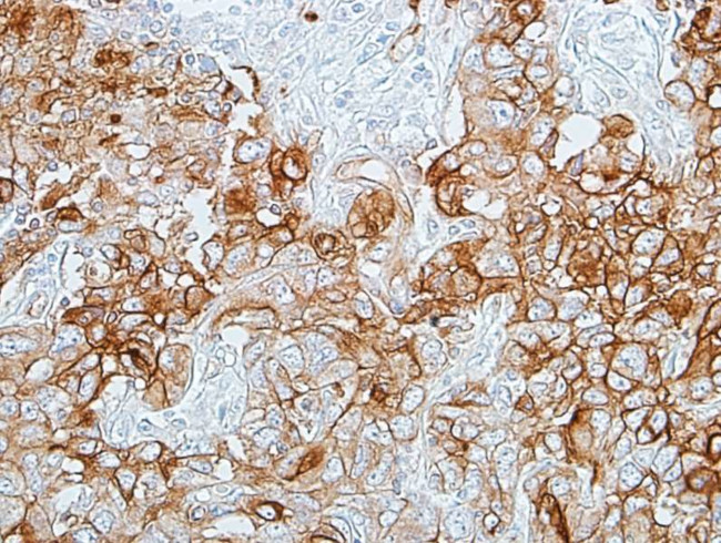 CD66a (CEACAM1) Antibody in Immunohistochemistry (Paraffin) (IHC (P))