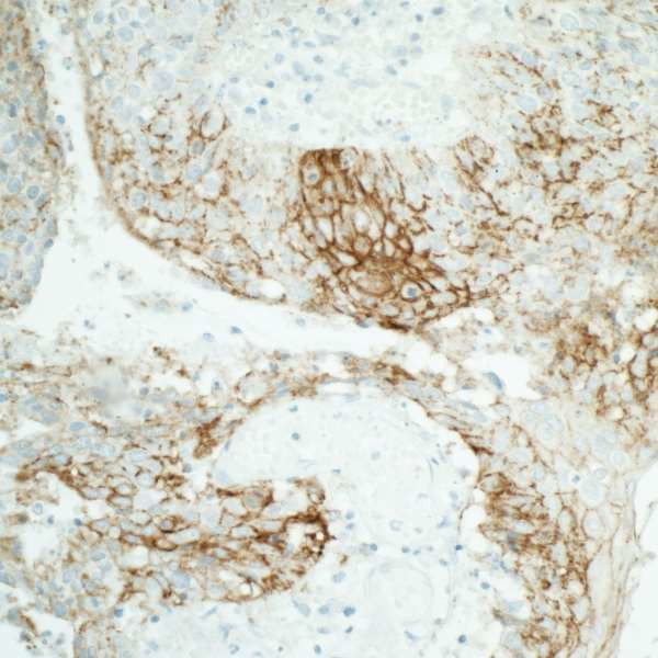 Claudin 1 Antibody in Immunohistochemistry (Paraffin) (IHC (P))