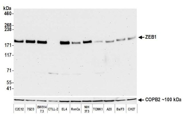 ZEB1 Antibody in Western Blot (WB)