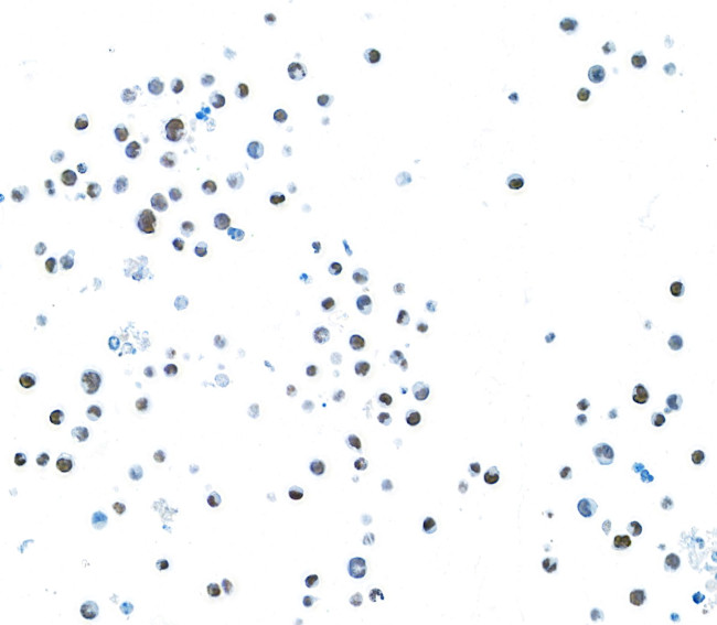 EOMES Antibody in Immunocytochemistry (ICC/IF)