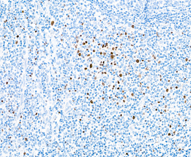 EOMES Antibody in Immunohistochemistry (Paraffin) (IHC (P))