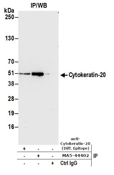 Cytokeratin 20 Antibody in Immunoprecipitation (IP)