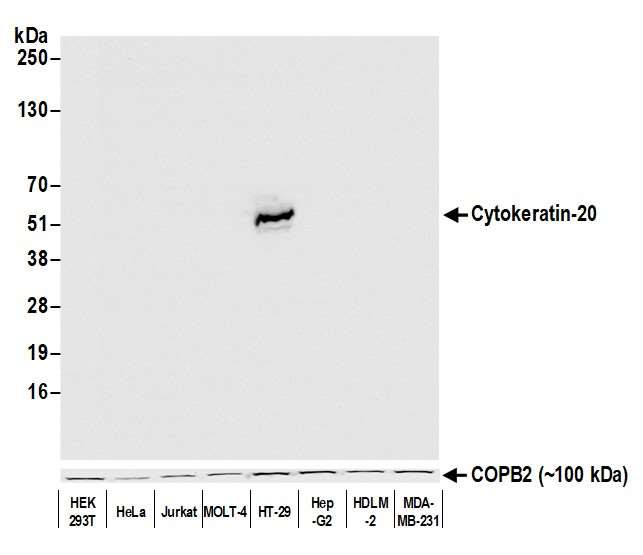 Cytokeratin 20 Antibody in Western Blot (WB)