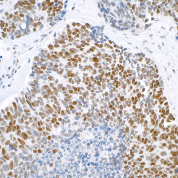 BRG1 Antibody in Immunohistochemistry (Paraffin) (IHC (P))