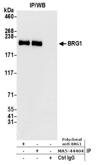BRG1 Antibody in Immunoprecipitation (IP)