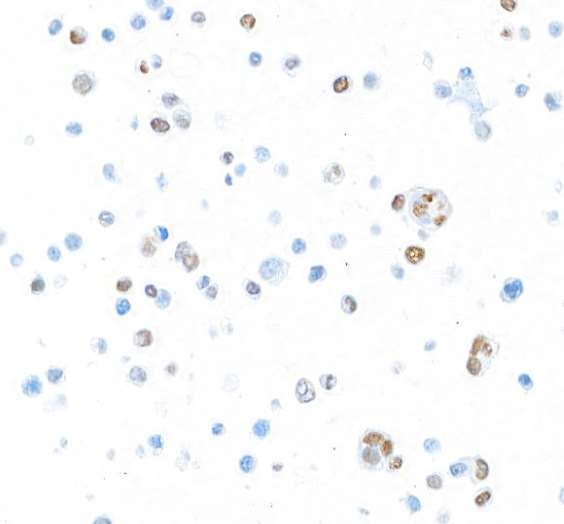 T-bet Antibody in Immunocytochemistry (ICC/IF)