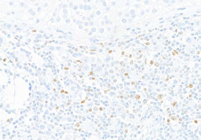 T-bet Antibody in Immunohistochemistry (Paraffin) (IHC (P))