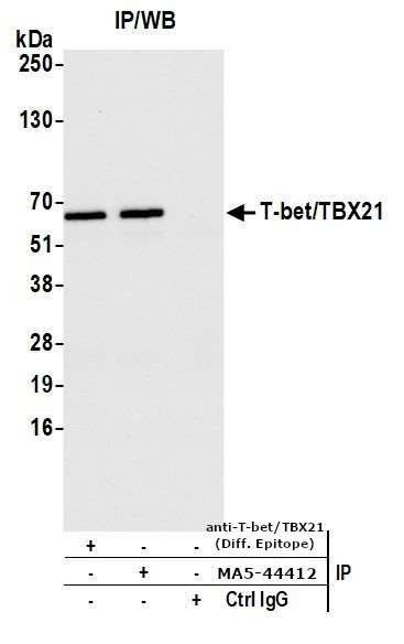 T-bet Antibody in Immunoprecipitation (IP)