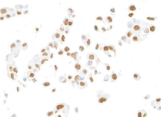 MLH1 Antibody in Immunocytochemistry (ICC/IF)