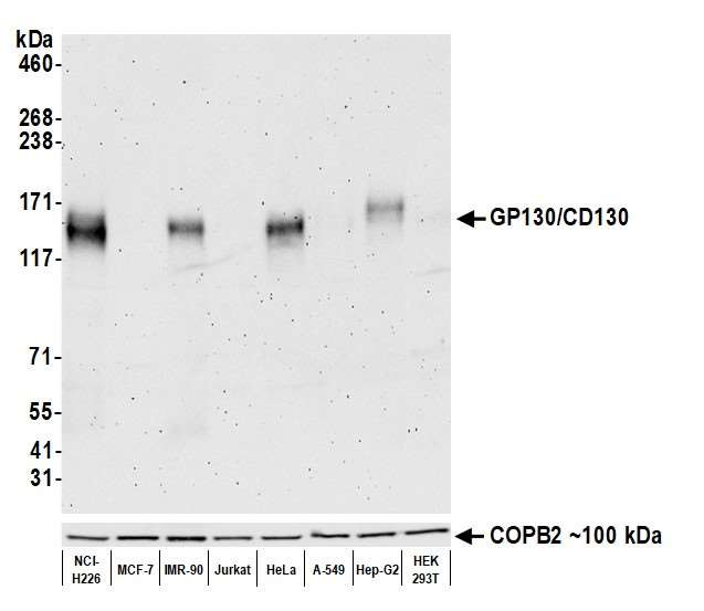 CD130 (GP130) Antibody in Western Blot (WB)