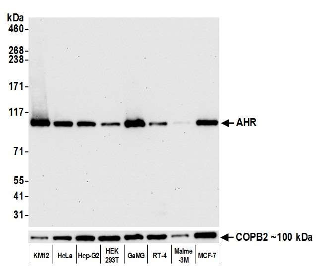 AHR Antibody in Western Blot (WB)