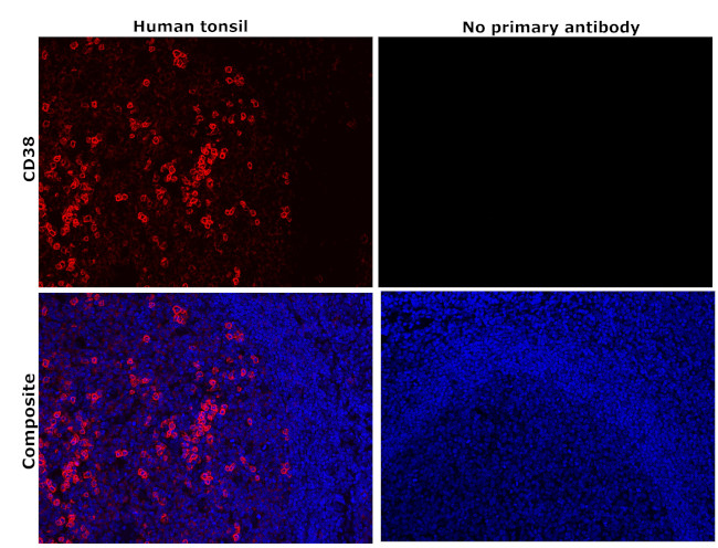 CD38 Antibody in Immunohistochemistry (Paraffin) (IHC (P))