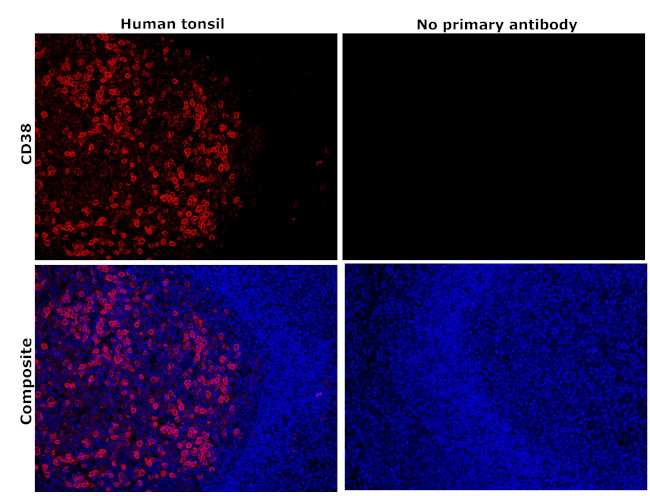 CD38 Antibody in Immunohistochemistry (Paraffin) (IHC (P))