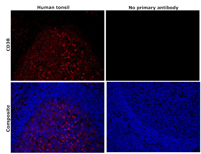 CD38 Antibody in Immunohistochemistry (Paraffin) (IHC (P))