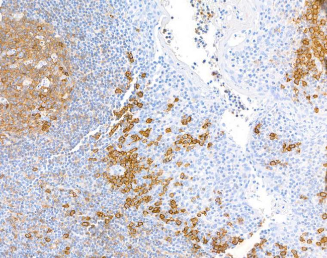 CD38 Antibody in Immunohistochemistry (Paraffin) (IHC (P))