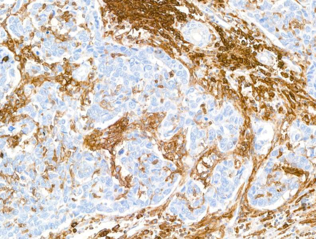 CD38 Antibody in Immunohistochemistry (Paraffin) (IHC (P))