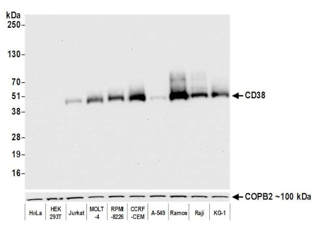 CD38 Antibody in Western Blot (WB)