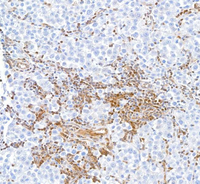 STAT5 alpha Antibody in Immunohistochemistry (Paraffin) (IHC (P))