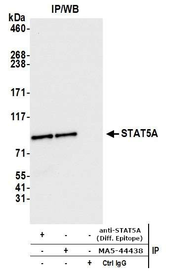 STAT5 alpha Antibody in Immunoprecipitation (IP)