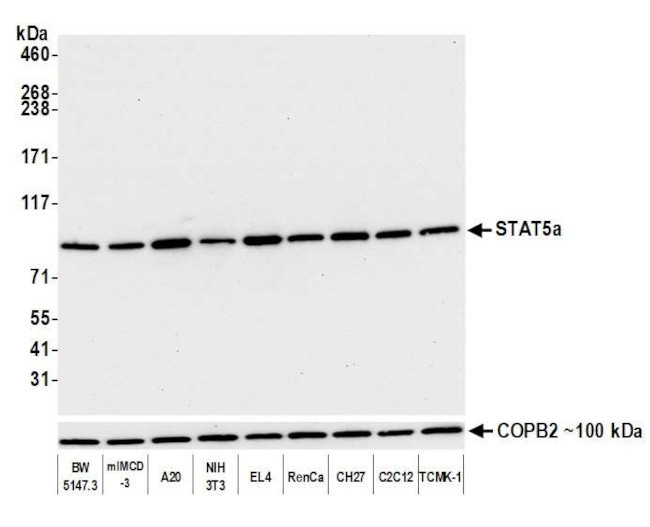 STAT5 alpha Antibody in Western Blot (WB)