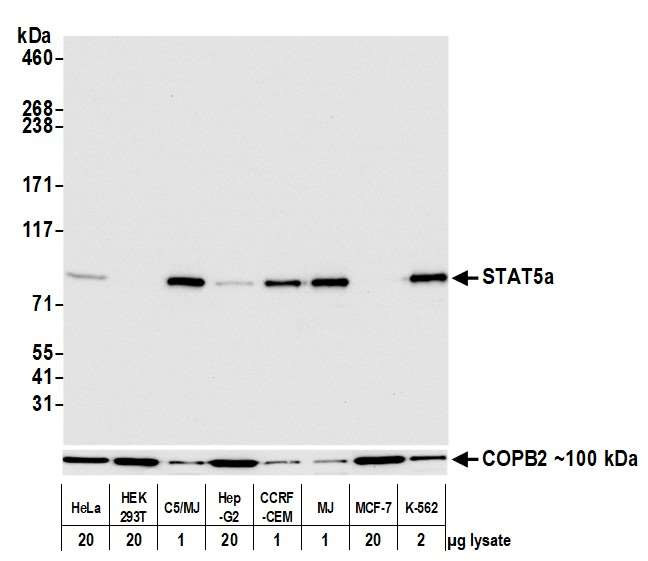 STAT5 alpha Antibody in Western Blot (WB)