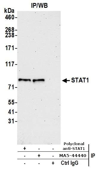 STAT1 Antibody in Immunoprecipitation (IP)